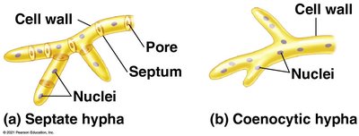 Septate and coenocytic hyphae diagram