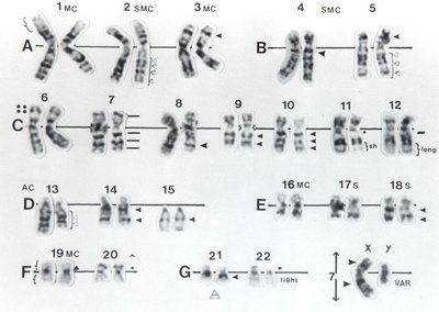 Human karyotype with chromosome groups
