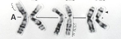 Close-up of group A chromosomes