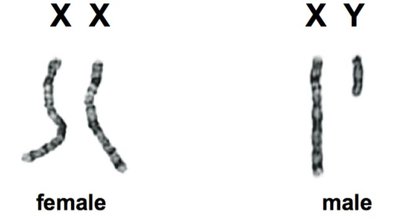 Sex chromosomes: XX (female) and XY (male)