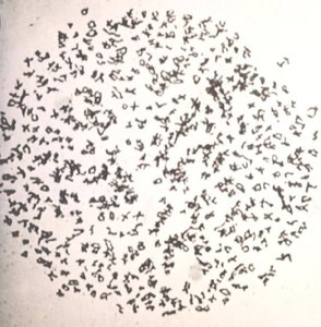 Karyotype of Ophioglossum reticulatum (fern) with highest chromosome count
