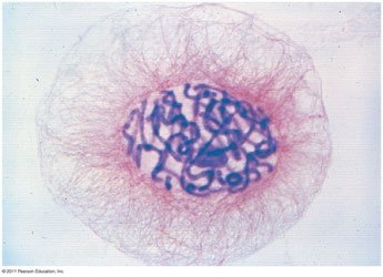Condensed chromosomes in a eukaryotic cell