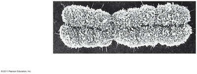 Electron micrograph of a condensed chromosome