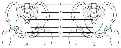 Comparison of male and female pelvic bones