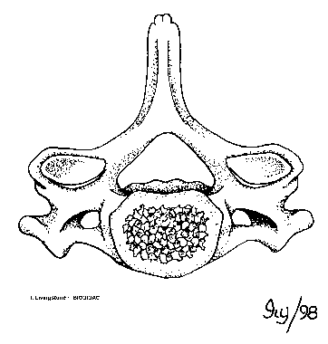 Cervical vertebra (superior view)