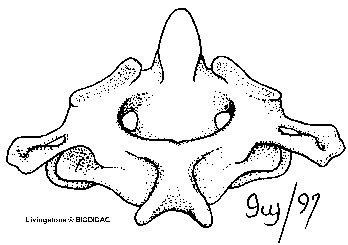 Thoracic vertebra (superior view)
