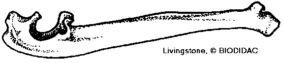 Ulna (forearm bone)