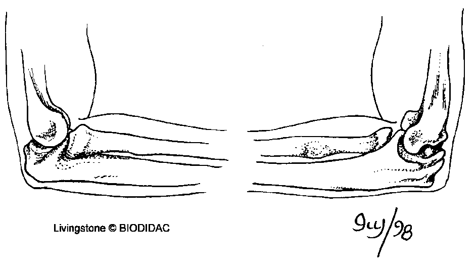 Elbow joint (humerus, ulna, radius)