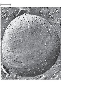 Electron micrograph of the nuclear envelope