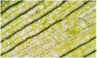 Microscope image of Elodea leaf cells