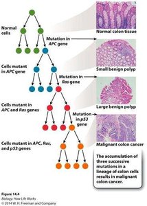 Colon cancer progression