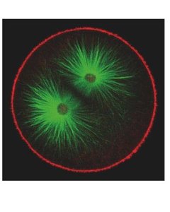 Microfilaments (red) and microtubules (green) in a cell
