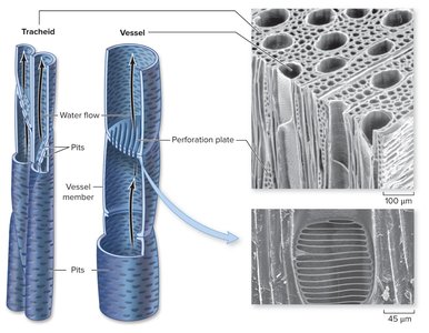 Diagram and micrographs of tracheids and vessel elements in xylem
