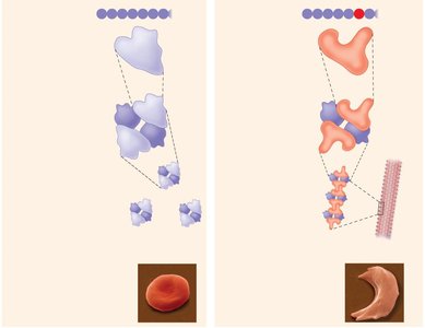 Normal and sickle cell hemoglobin structure and red blood cell shape