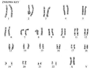 Diagram of alleles in a diploid organism, showing homozygous and heterozygous states