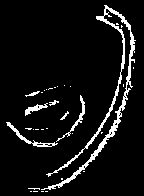 Indeterminate form and factoring