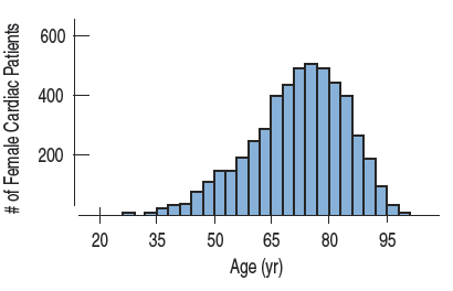 Histogram skewed to the left