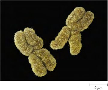 Eukaryotic chromosomes