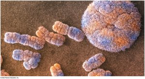 Electron micrograph of chromosomes and nucleus