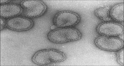 Electron micrograph of Influenza virus