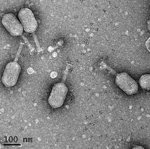 Electron micrograph of T4 bacteriophage