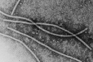 Electron micrograph of Potato virus X