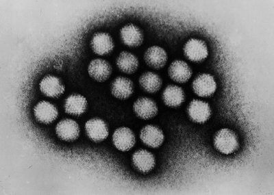 Electron micrograph of Adenovirus