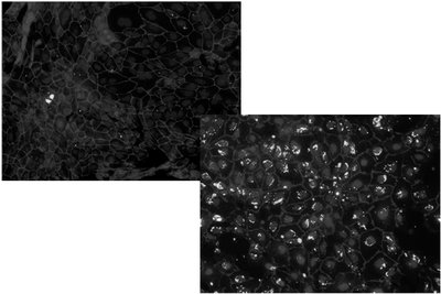 Tracer experiment showing tight junction barrier