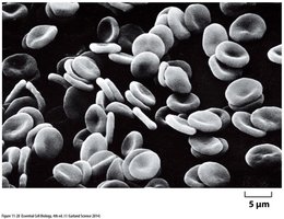 Biconcave shape of red blood cells