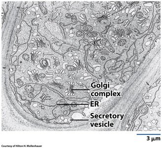 Electron micrograph of Golgi complex and ER