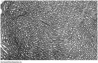 Electron micrograph showing ER and Golgi complex