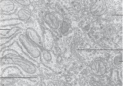 Electron micrograph of cell organelles