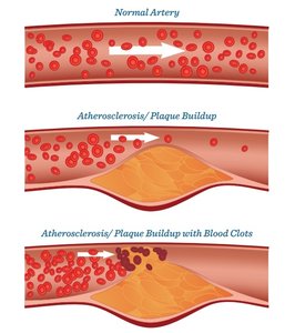 Saturated and unsaturated fatty acid comparison