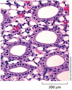 Histological section of tissue showing organization of cells