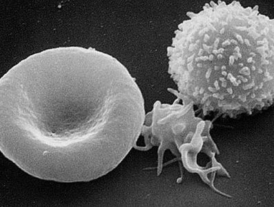 Electron micrograph of different blood cells