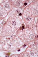 Light microscopy of nucleolus