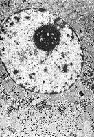 Electron micrograph of nucleolus