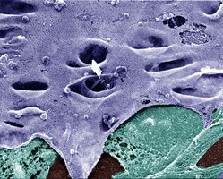 Nuclear envelope and associated structures