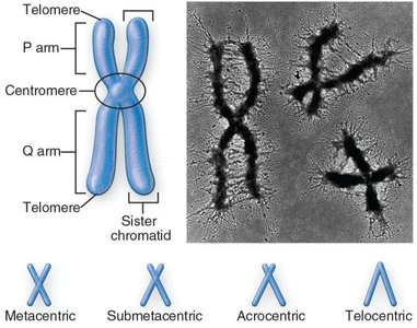 Diagram and micrograph of chromosome structure and types