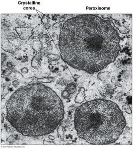 DAB-stained peroxisome in plant cell