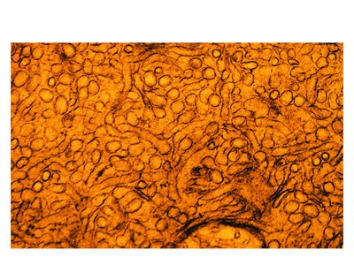 Smooth ER without ribosomes