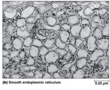 Electron micrograph of smooth endoplasmic reticulum