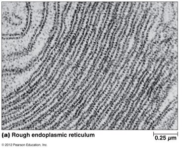 Electron micrograph of rough endoplasmic reticulum