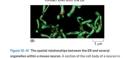 Contact sites between ER and other organelles in a mouse neuron