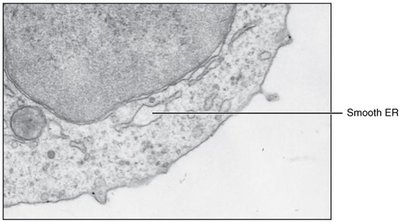 Electron micrograph of rough ER with ribosomes