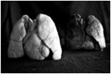 Healthy and smoker's lungs