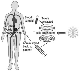 CAR-T cell therapy process
