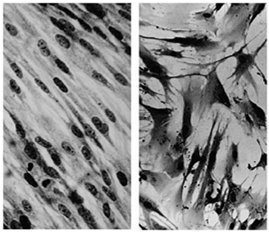 Cancer cell line in culture