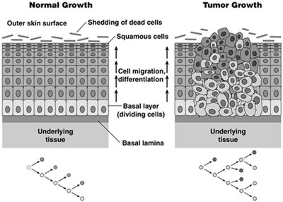 Comparison of normal and tumor growth in epithelium
