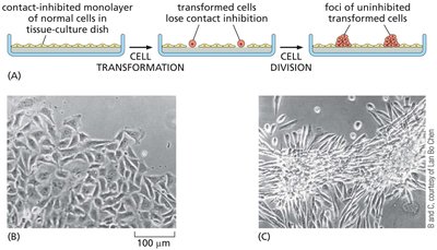Contact inhibition loss in cancer cells in culture